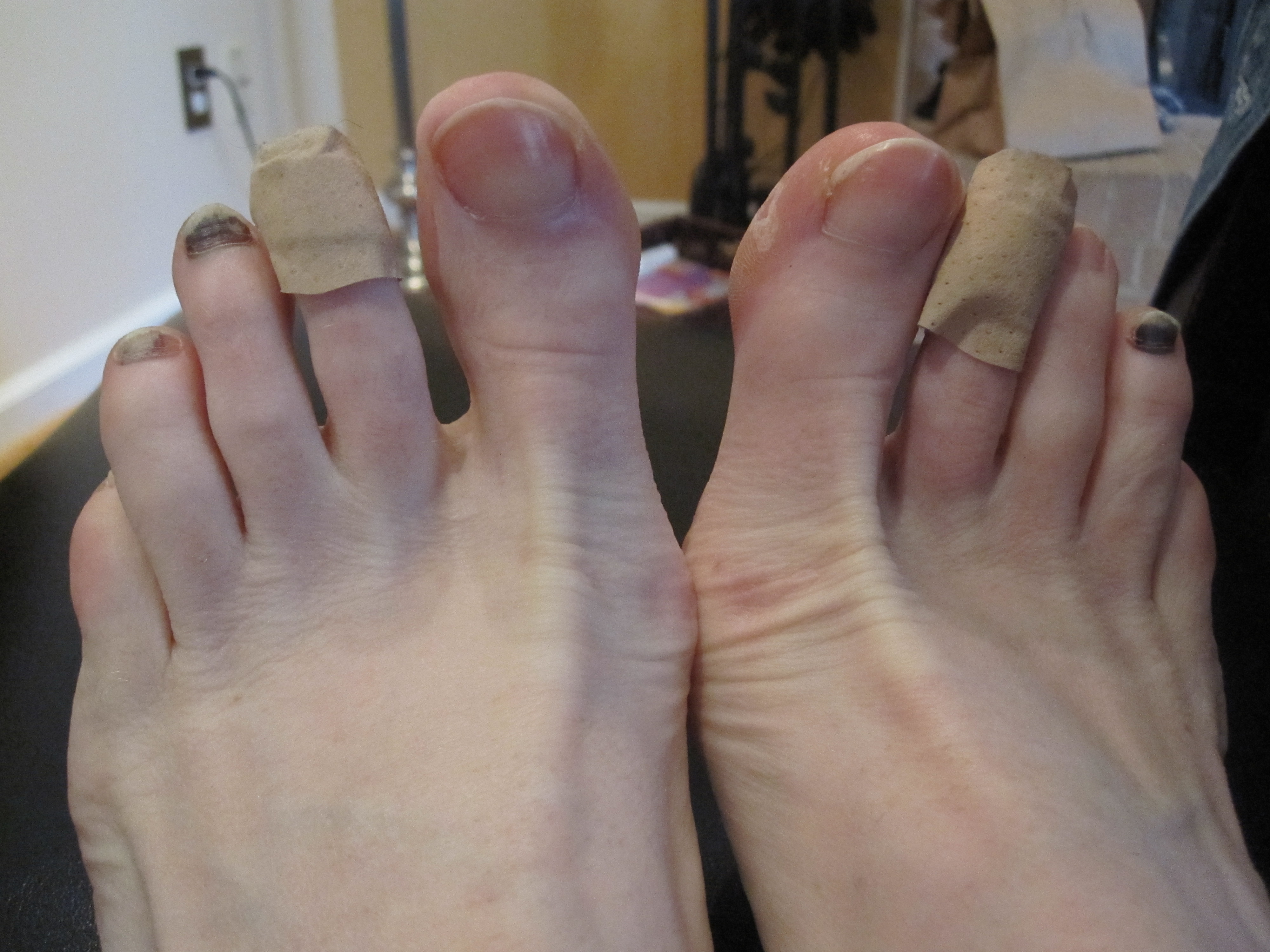 black pinky toe